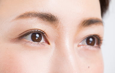 目元手術