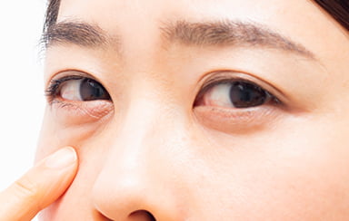 脱脂手術