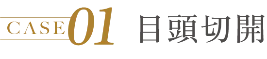 CASE 01 目頭切開