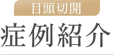 目頭切開 症例紹介