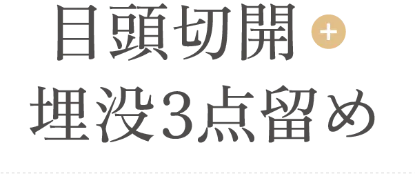 目頭切開+埋没3点留め